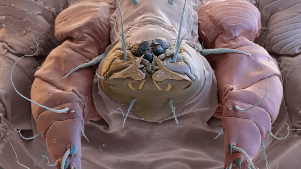 Microscopic Creatures Eating Your Skin